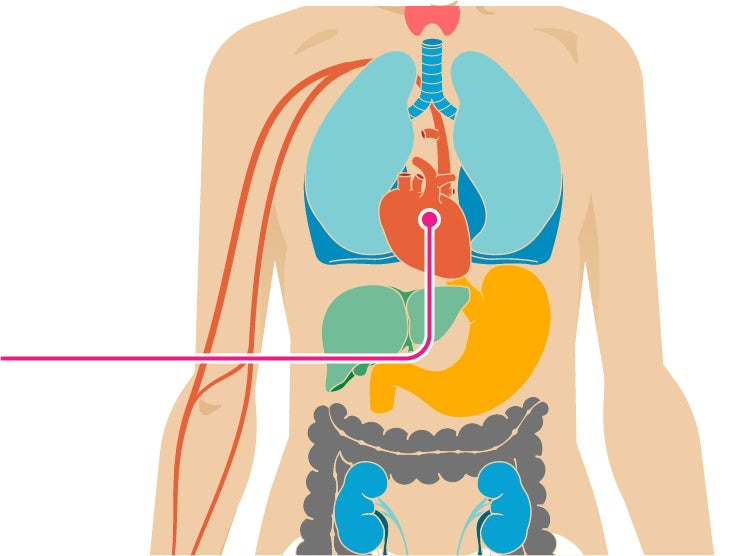 13 Effects Of Fast Food On The Body