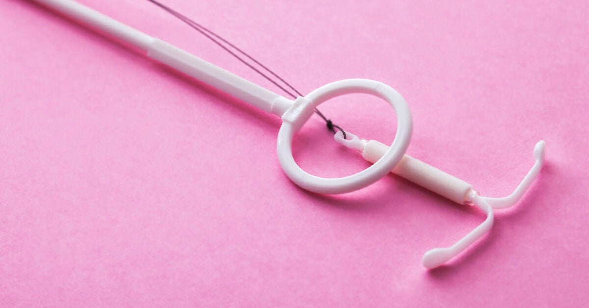 Iud Removal What To Expect