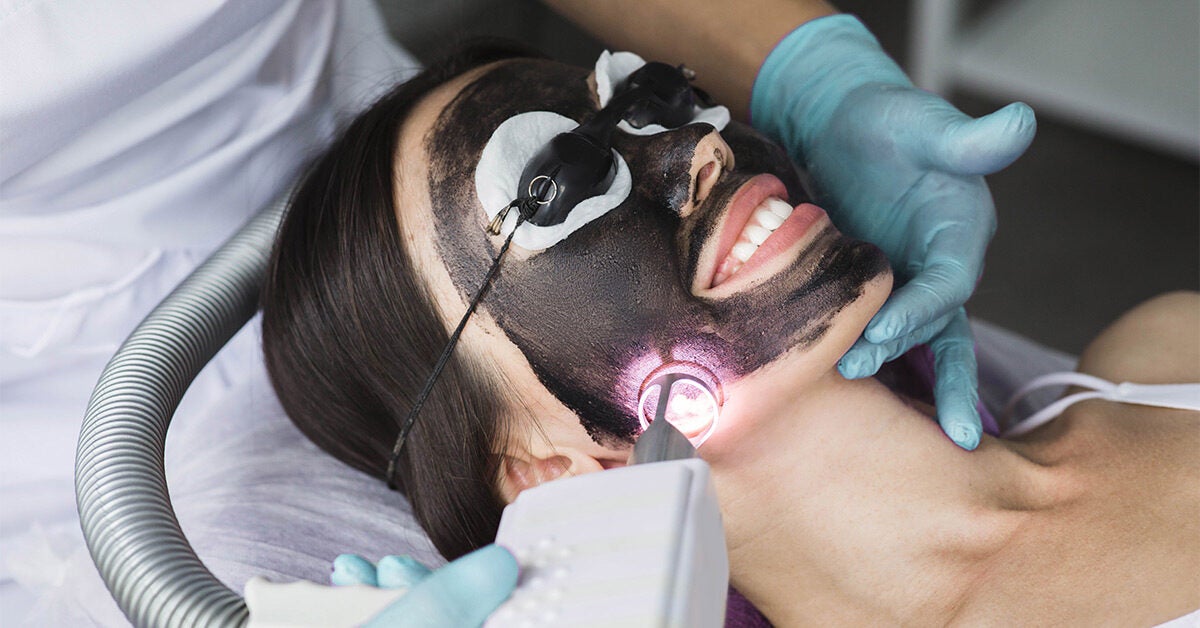 Everything You Need To Know About Laser Carbon Peels