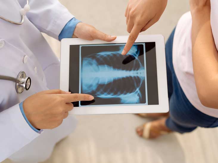 Lung Diffusion Testing Purpose, Procedure, and Results
