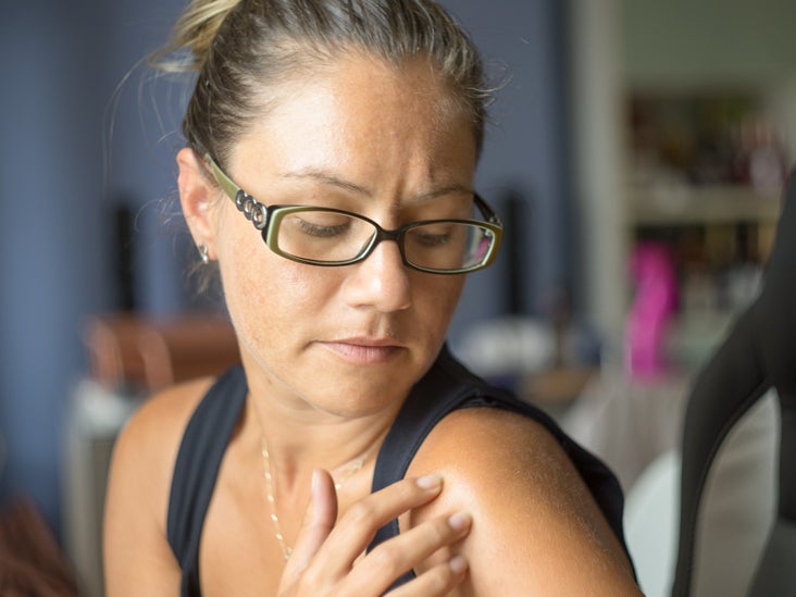 Metastatic Melanoma Symptoms Treatment And Outlook