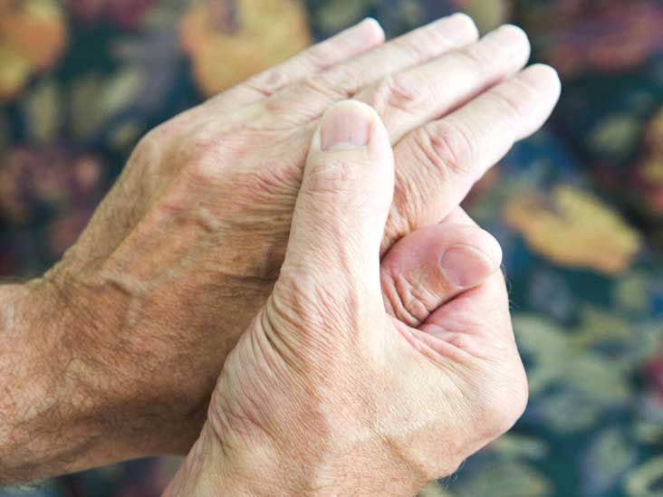 Rheumatoid Arthritis Symptoms Causes Treatment And More