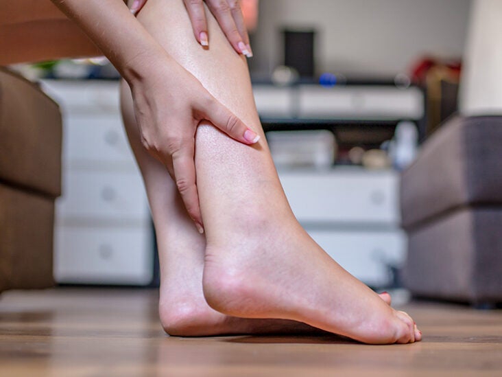 pictures of swollen ankles due to congestive heart failure