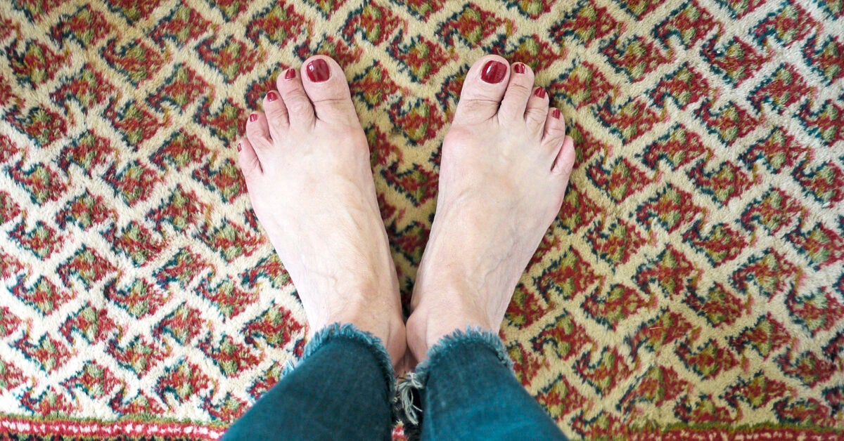 wart causing foot pain