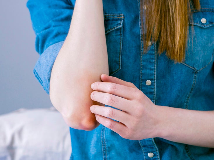 18 Causes of Bump on Elbow: Injury, Cyst, Bursitis, and More