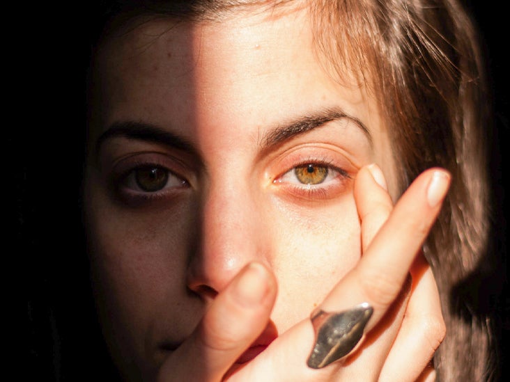 What Causes Dry Eyes