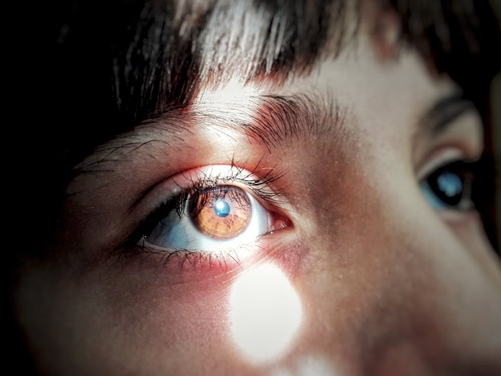 livstid Raffinere Tilgivende Dealing with Chronic Dry Eye and Photophobia