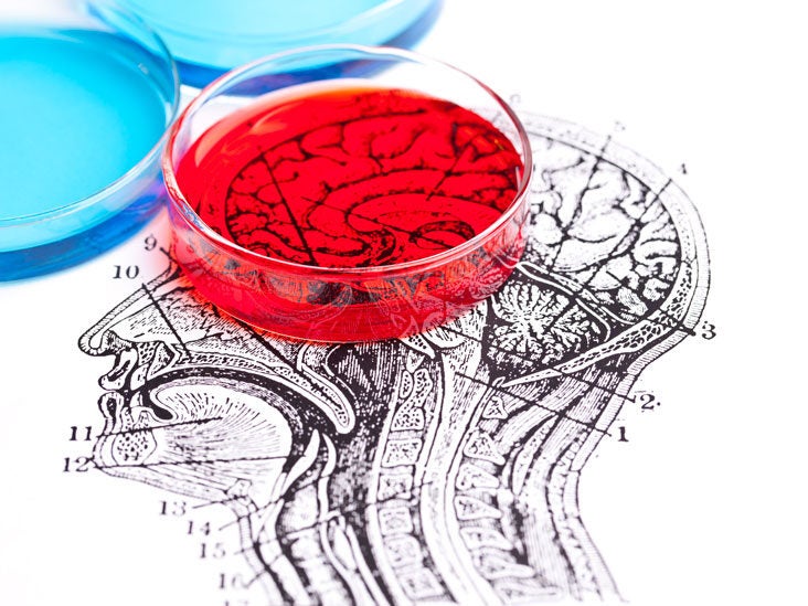 Cerebral Spinal Fluid Csf Analysis