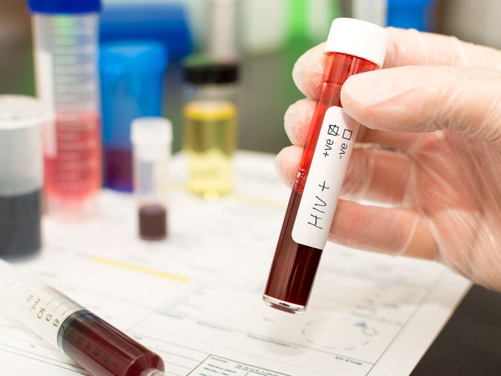 price of hiv test kit