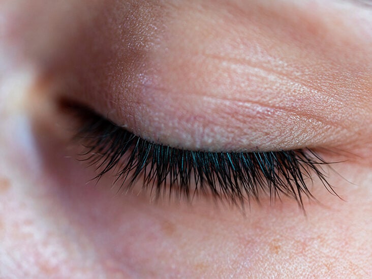 Do Eyelashes Grow Back? Causes, Treatments, and More