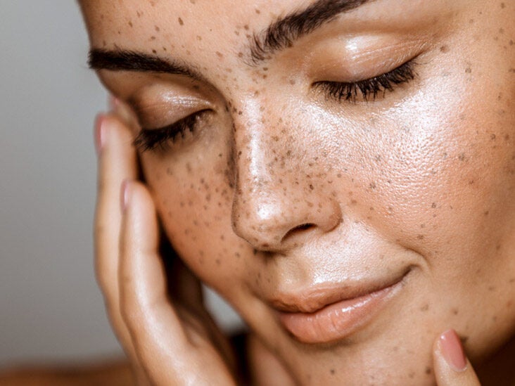 How to heal skin overnight