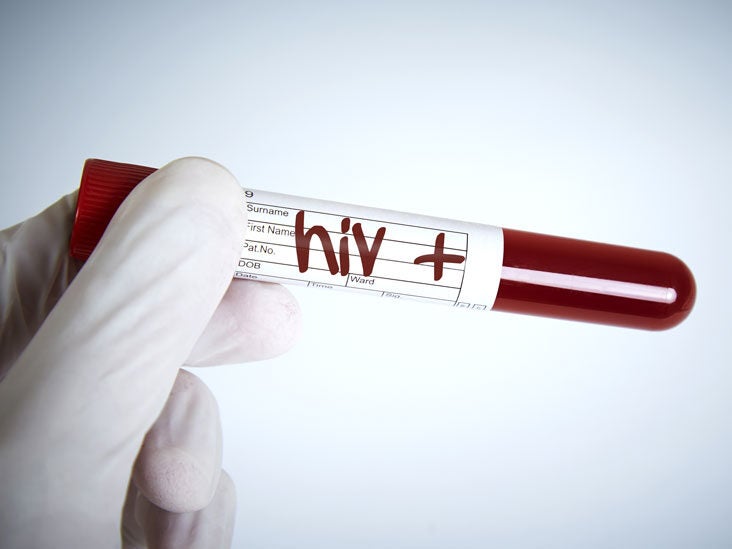 hiv home test kit