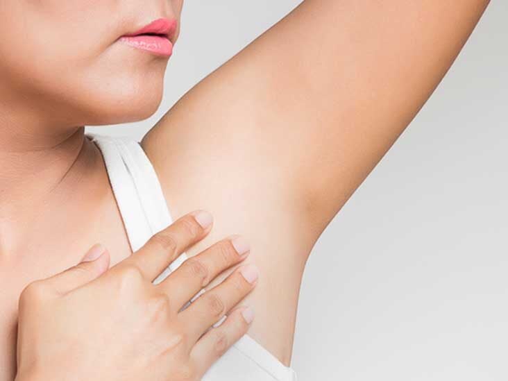 Armpit Rashes Causes Treatment And Prevention