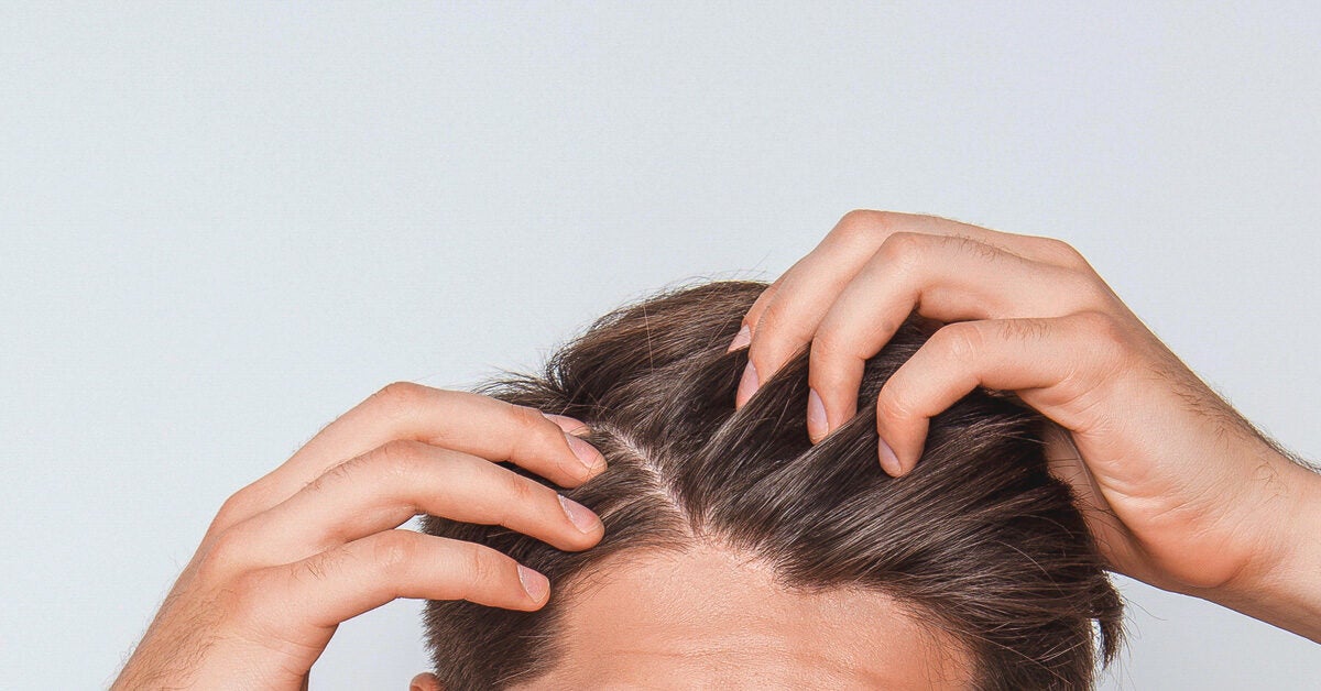 Scabs and Sores on Scalp: Treatment, Causes, and Remedies