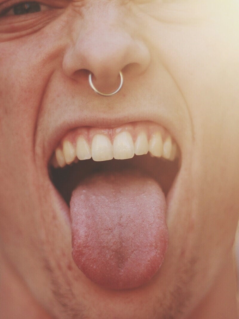 Tongue Cracks Symptoms And Causes 