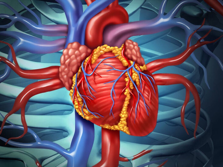 Risk Factors for Heart Disease Change Heart Structure and Appearance