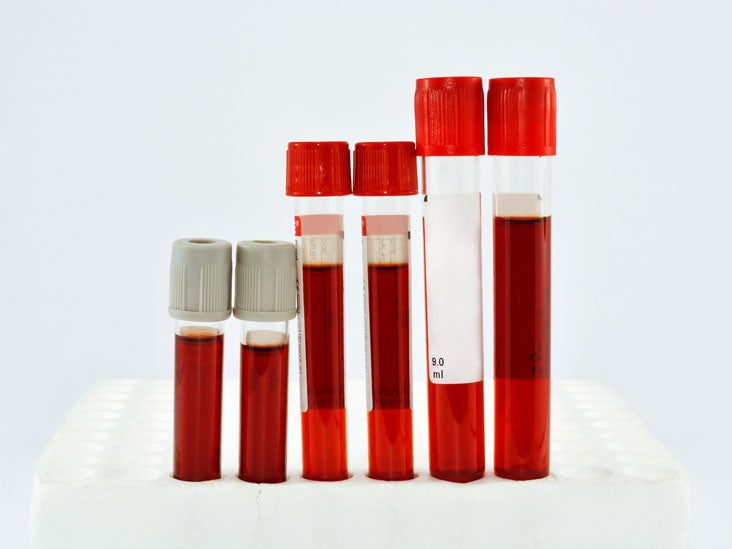 Red Blood Cell Count Procedure, and Preparation