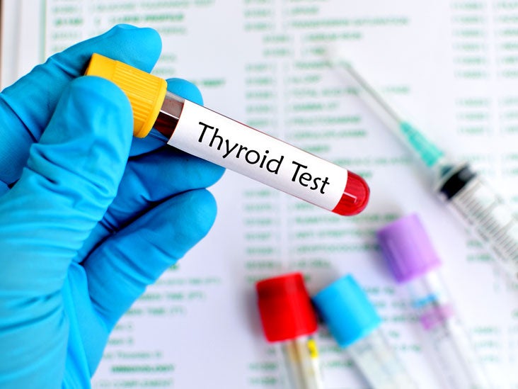 TSH (ThyroidStimulating Hormone) Test