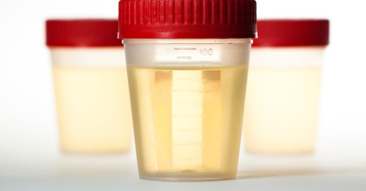 What Is Specific Gravity Of Urine 1 003 Means