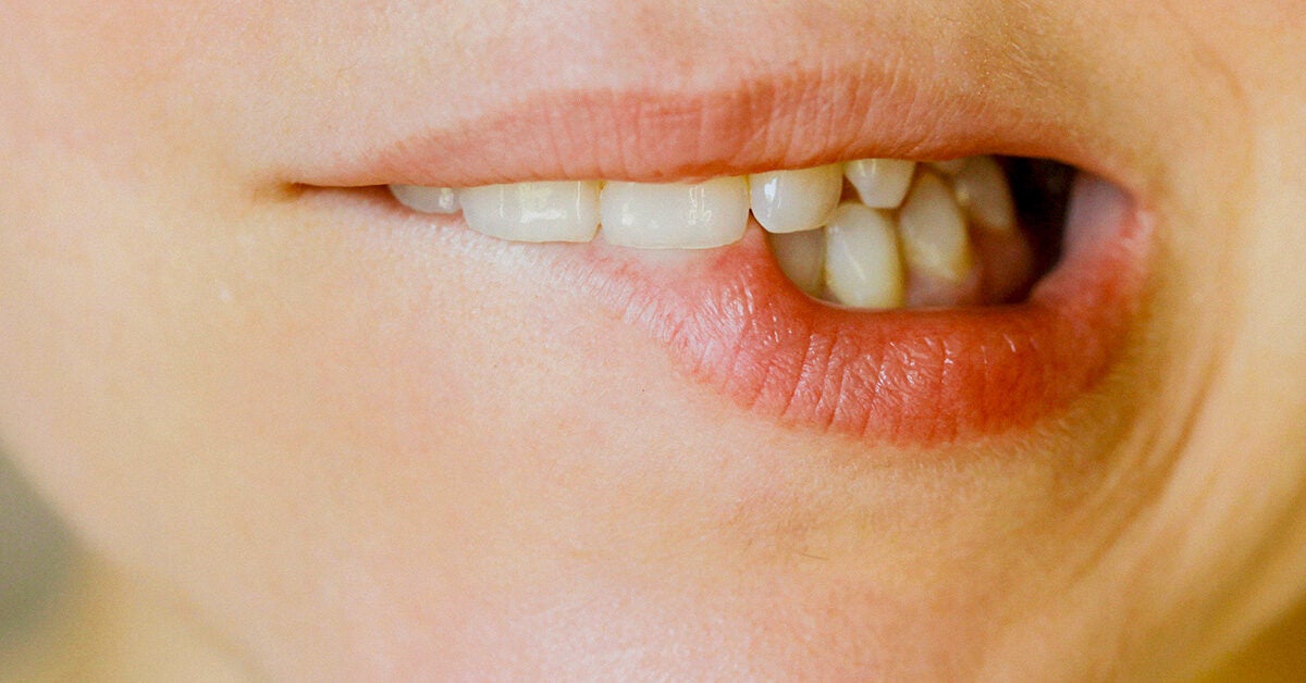 woman biting lip 1200x628 facebook