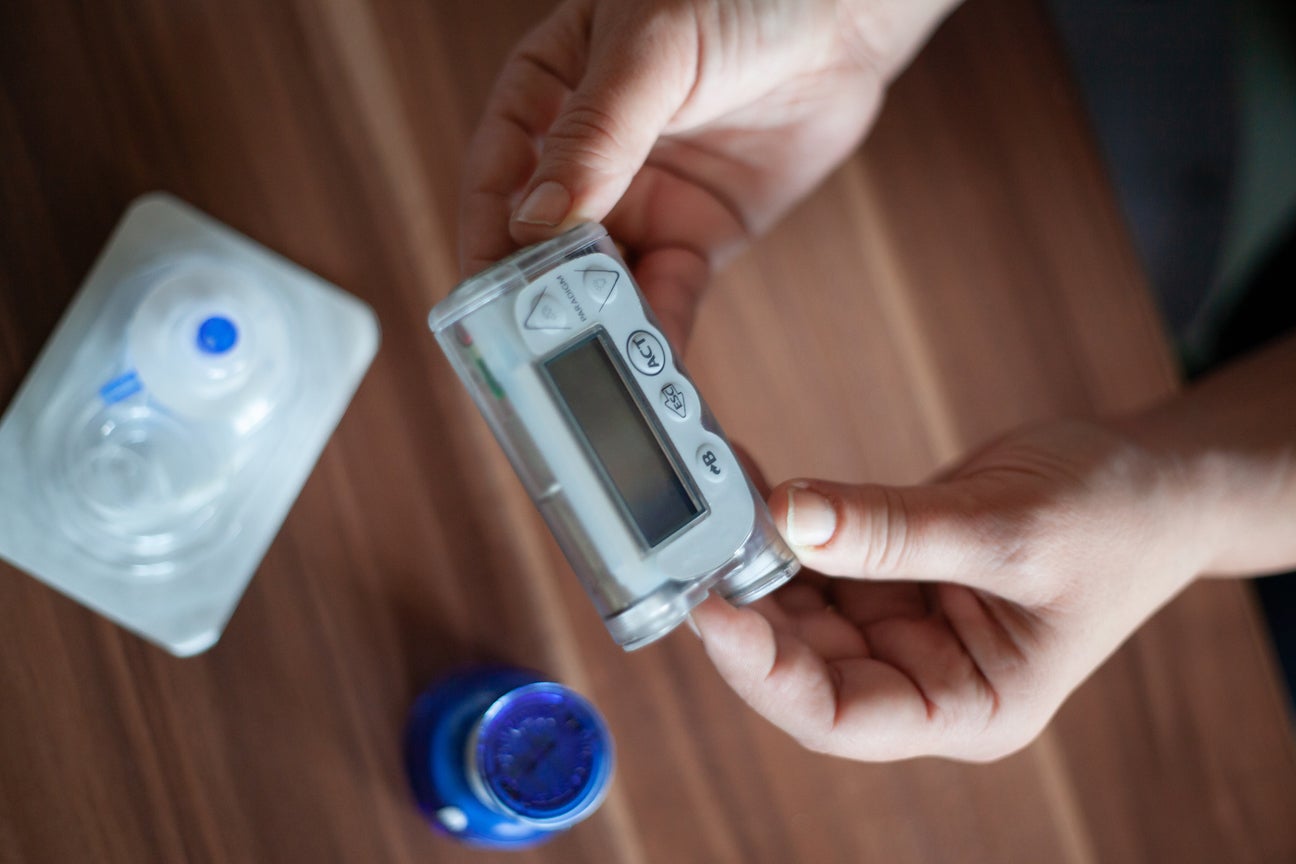 Troubleshooting Common Insulin Pump and CGM Problems