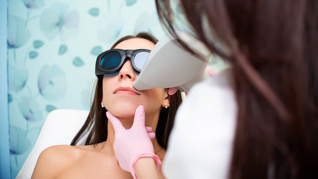 Laser Treatment for Facial Hair Removal: Procedure, Recovery