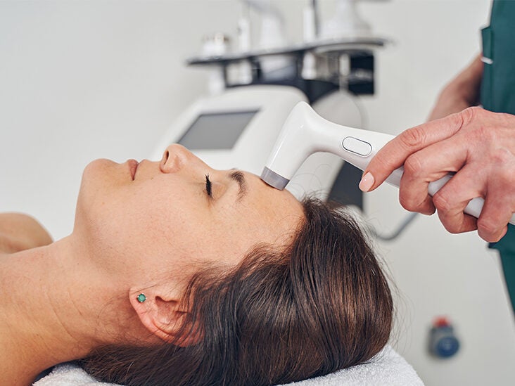 Laser Skin Tightening: What to Expect, Procedure, Results, Etc.