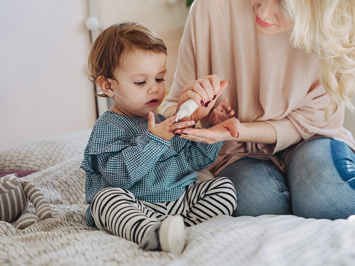 Hydrocortisone cream for baby acne