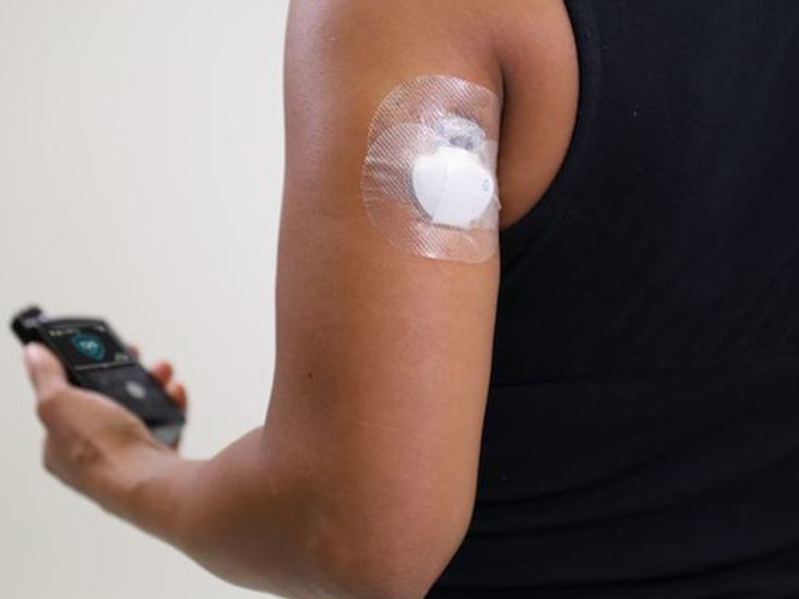 Medicare Expands Coverage for Continuous Glucose Monitors