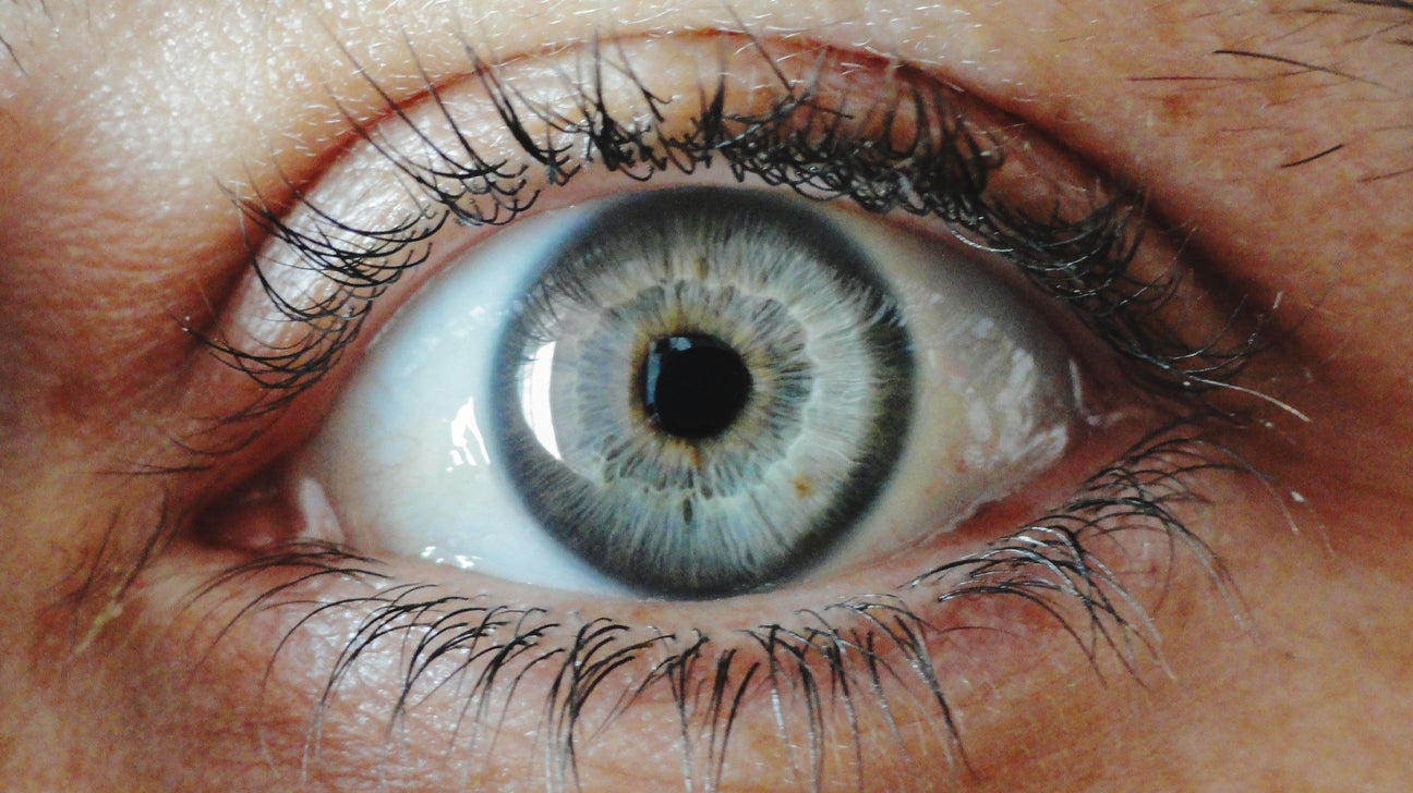 schreeuw Verplicht Maxim Limbal Rings: What They Are and Who Has Them