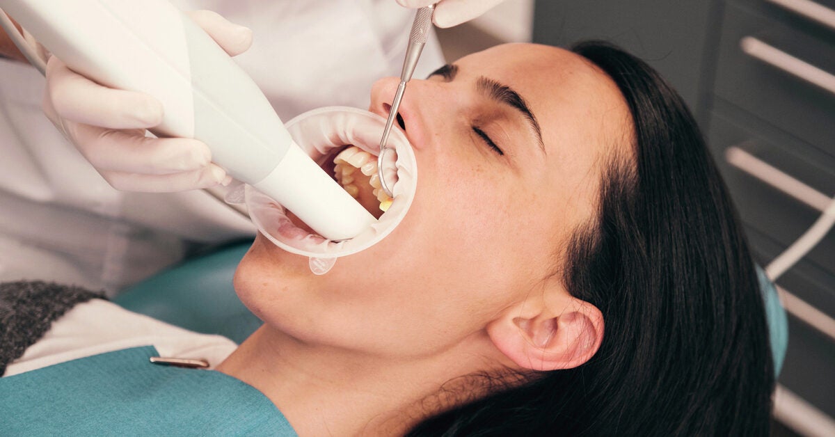 What Are The Advantages And Disadvantages Of Professional Teeth Cleaning?