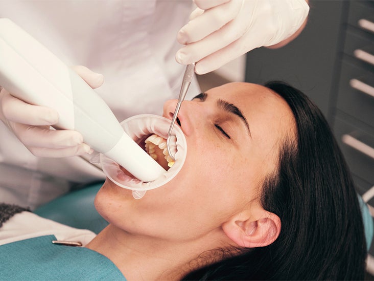 Teeth Cleaning Bydental Clinic Singapore Services