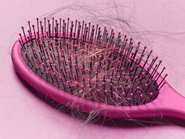 Hair Loss After Surgery: Causes, Treatment, and Prevention