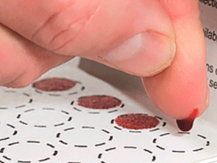 A New Home Testing Kit Screens for Type 1 Diabetes - Vimarsana News