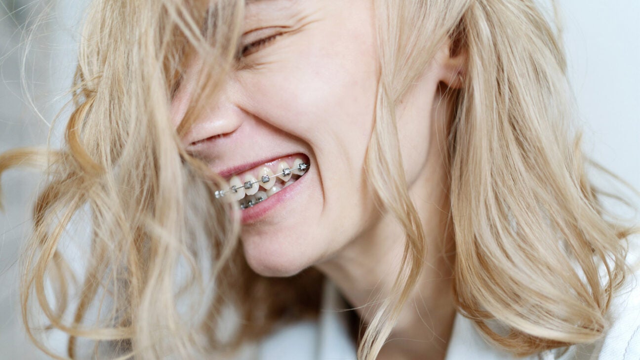 Self-Ligating Braces: How They Differ, Benefits, Cost