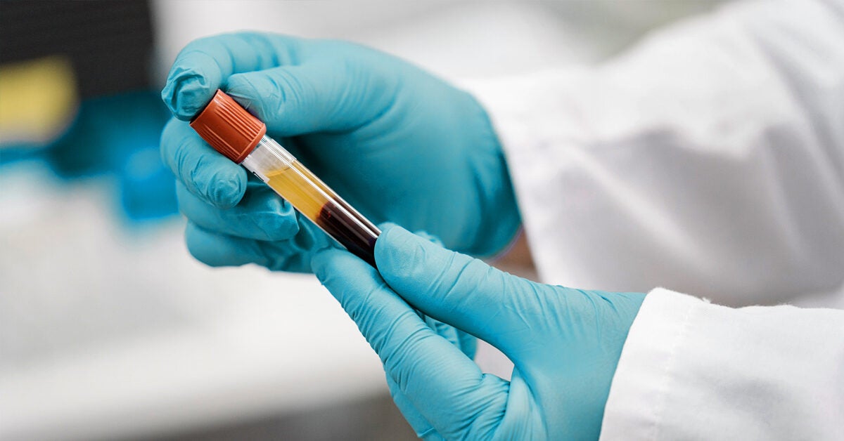 Blood Test For Gender Accuracy And How Early You Can Find Out