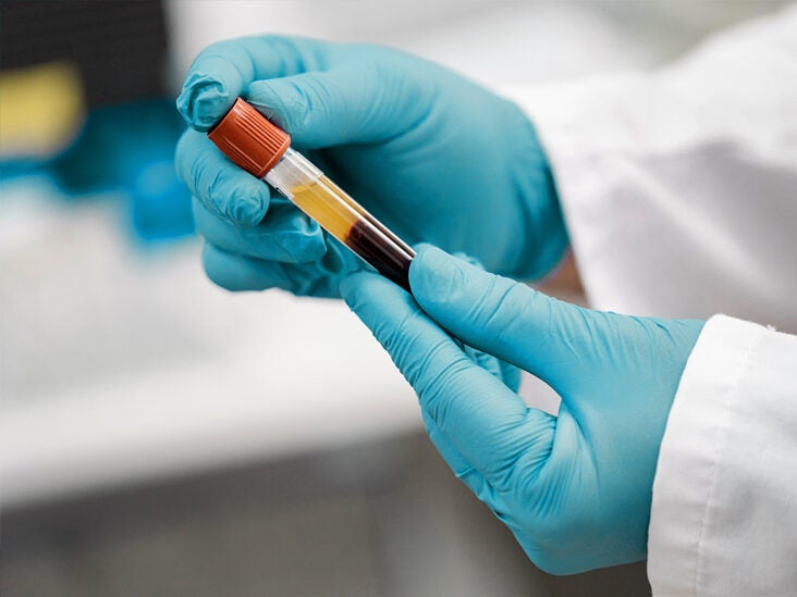 Blood Test for Gender