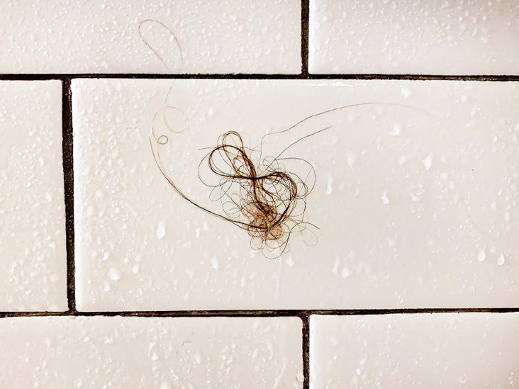 Hair Loss In Shower And Brushing Thin Hair Ties