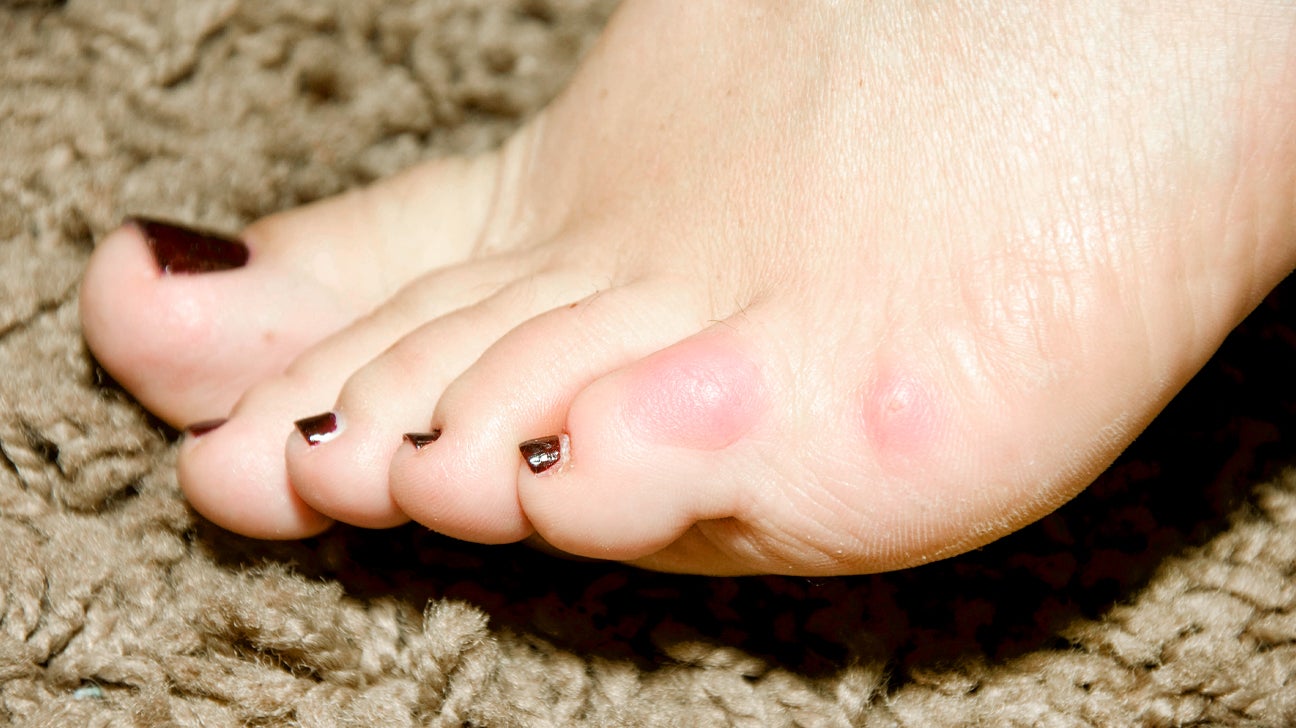 Ebony white toes