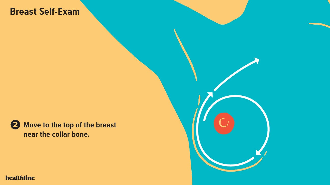 Breast Cyst vs