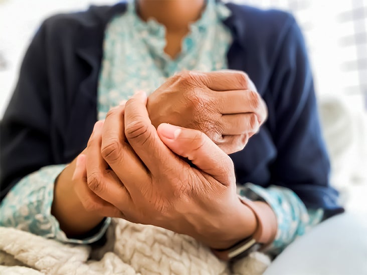 is psoriatic arthritis, a connective tissue disease