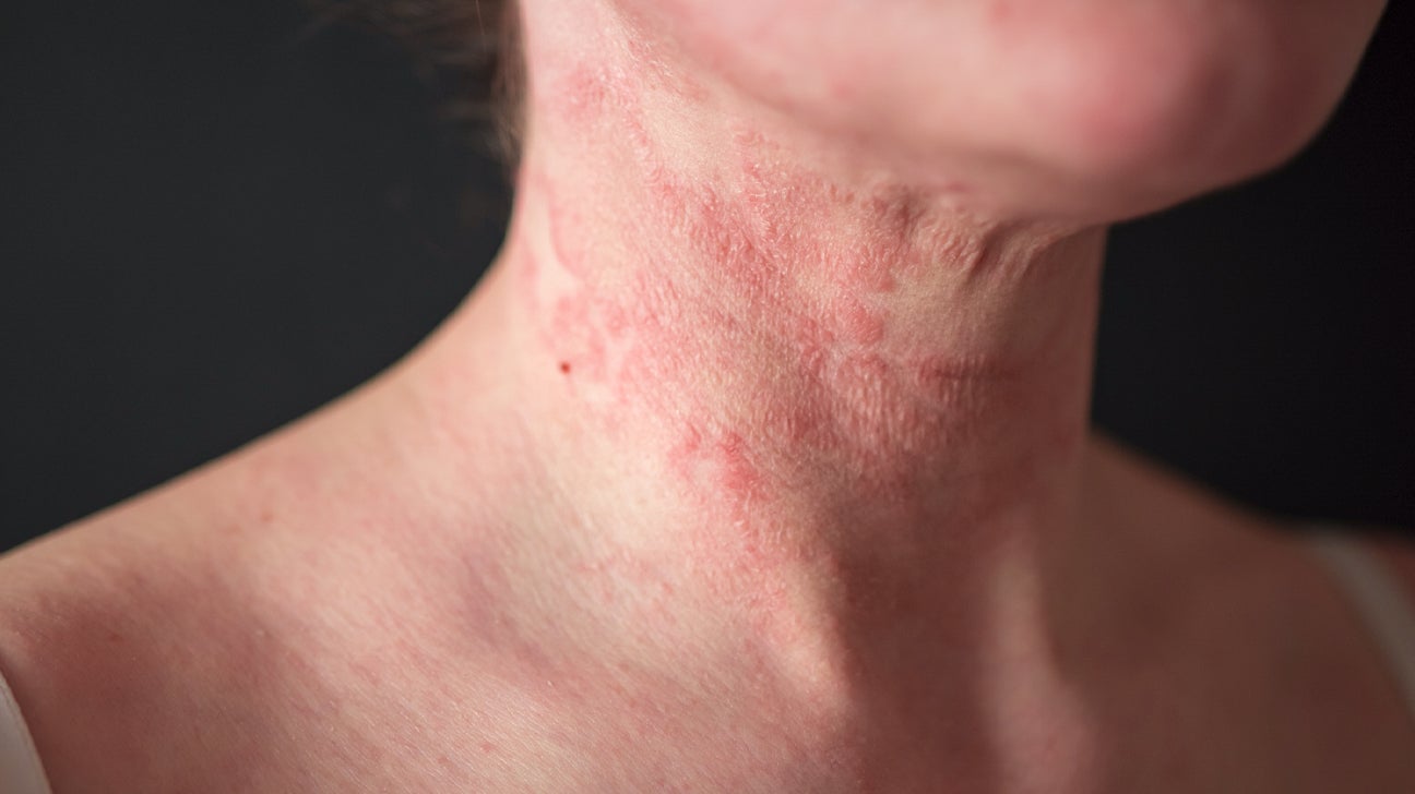 13 causes of red spots on the skin — Medipulse: Best Private Hospital in  Jodhpur