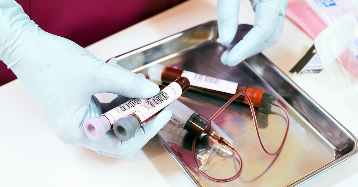western blot herpes test cost