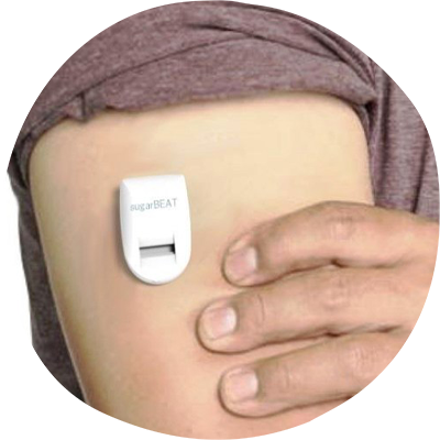 SugarBeat noninvasive glucose monitor