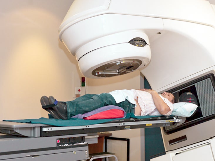 radiotherapy prostate cancer complications
