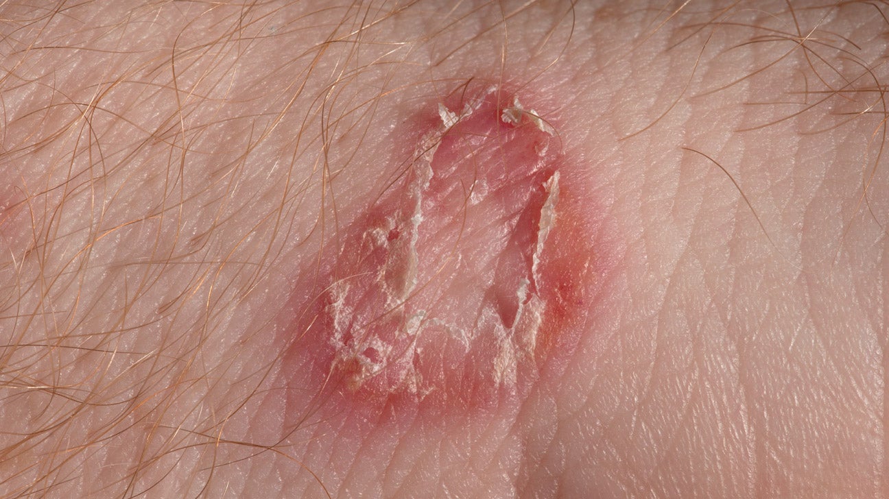 Itching What’s Causing Your Itchy Skin? (with Pictures)
