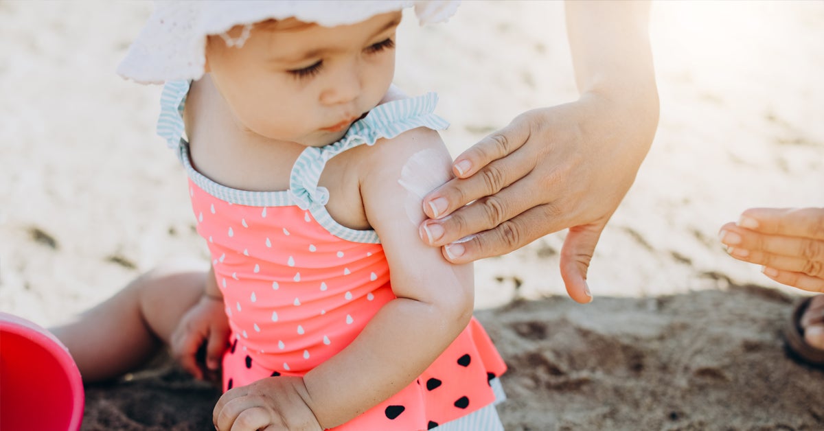 Baby Sunburn: Treatment, Prevention, Emergencies