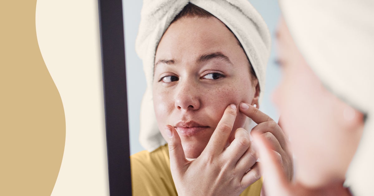 20 Best Acne Treatments in 2022