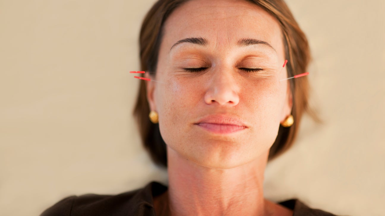 Perimenopause: 5 Ways Acupuncture Can Help - Encircle Acupuncture