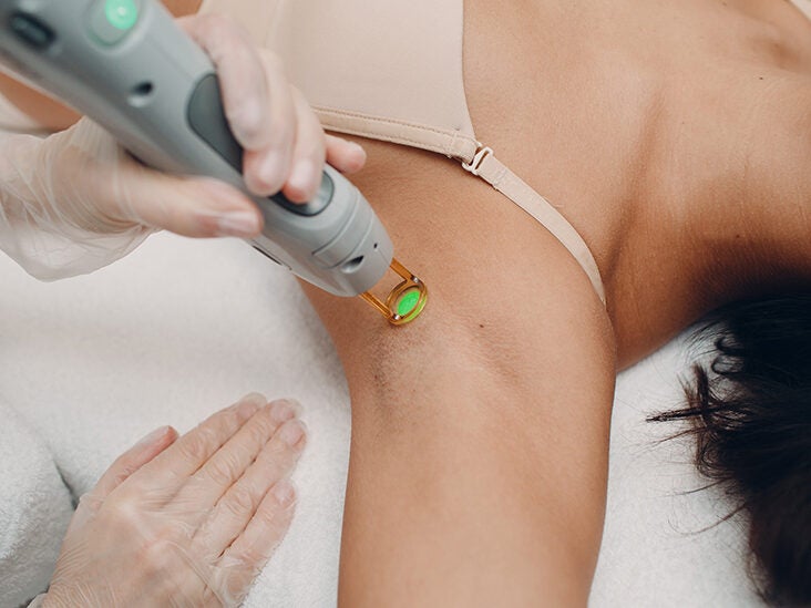 Laser Hair Removal vs. Electrolysis: What's the Difference?